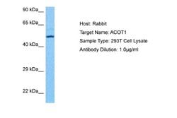 ACOT1 Rabbit anti-Human, Polyclonal, Novus Biologicals 0.1 mL | Buy Online | Novus Biologicals | Fisher Scientific